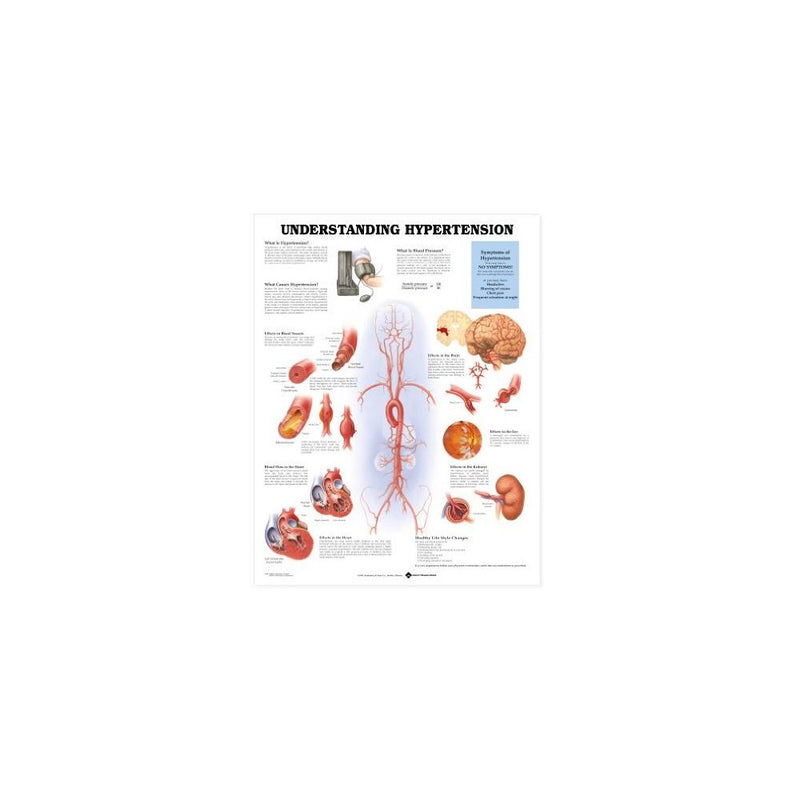 Understanding Hypertension Anatomical Chart