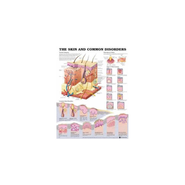 The Skin and Common Disorders Anatomical Chart